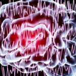 SPMC Records High Epilepsy Consults in Davao City