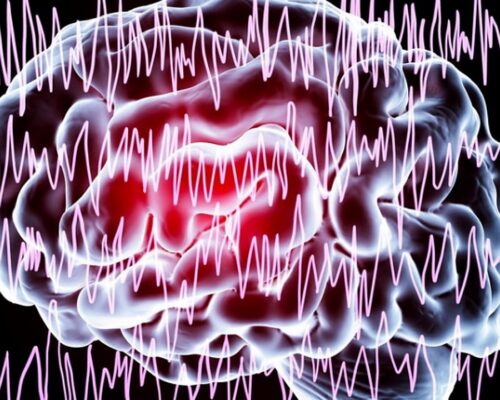 SPMC Records High Epilepsy Consults in Davao City